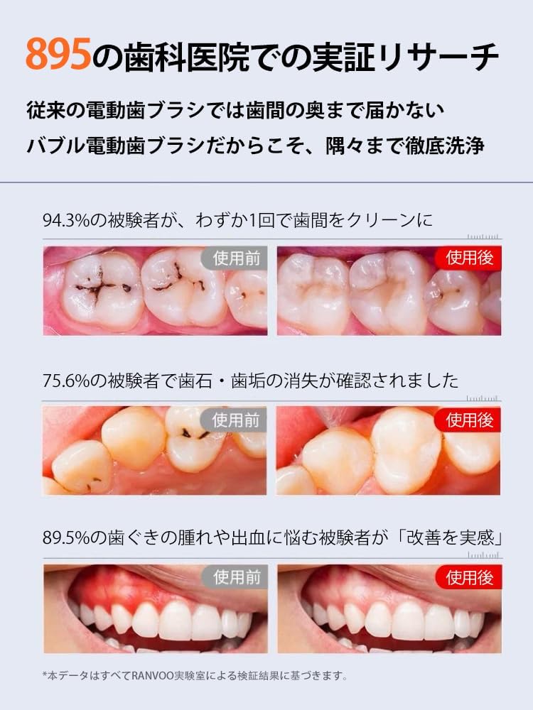 RANVOO AirJet 電動歯ブラシ ソニック RANVOO